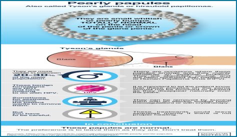 Can you Squeeze Pearly Penile Papules? Be Cautious of Scarring