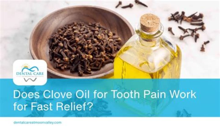 Does clove oil work for toothache?