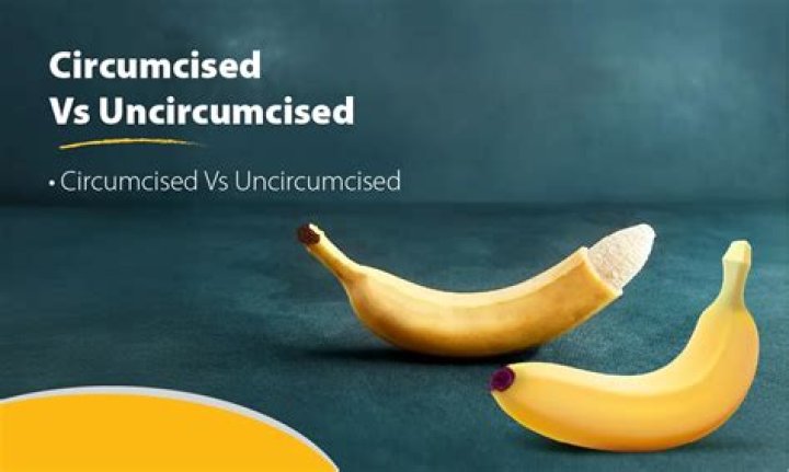 Why do Xhosa circumcise?